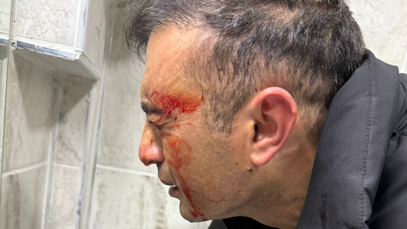 Teksas: Yapılan hiçbir kalleşliği unutmayız! Kan akıtanlarla hesabımız var!