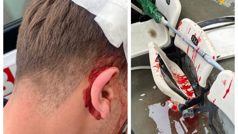 Muş’la beraber Bursaspor da PFDK’da! Dağ fare mi doğuracak?